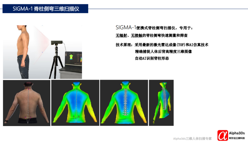SIGMA-1 便攜式脊柱側彎三維掃描儀-