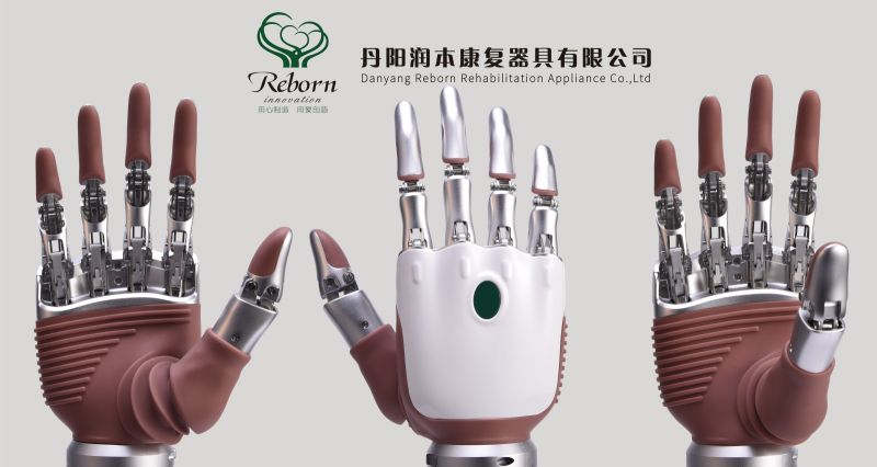 Intelligent Bionic Prosthesis-