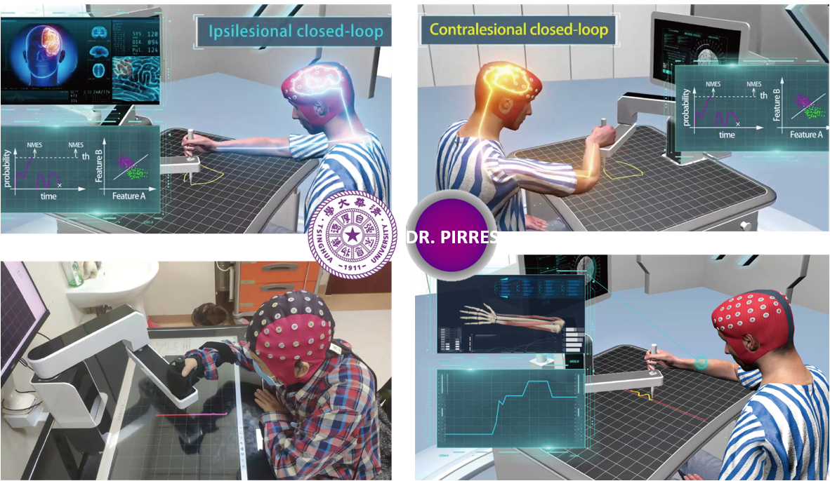 智能精準康復機器人專家系統