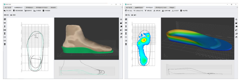 矯形鞋墊快速設計軟件-
